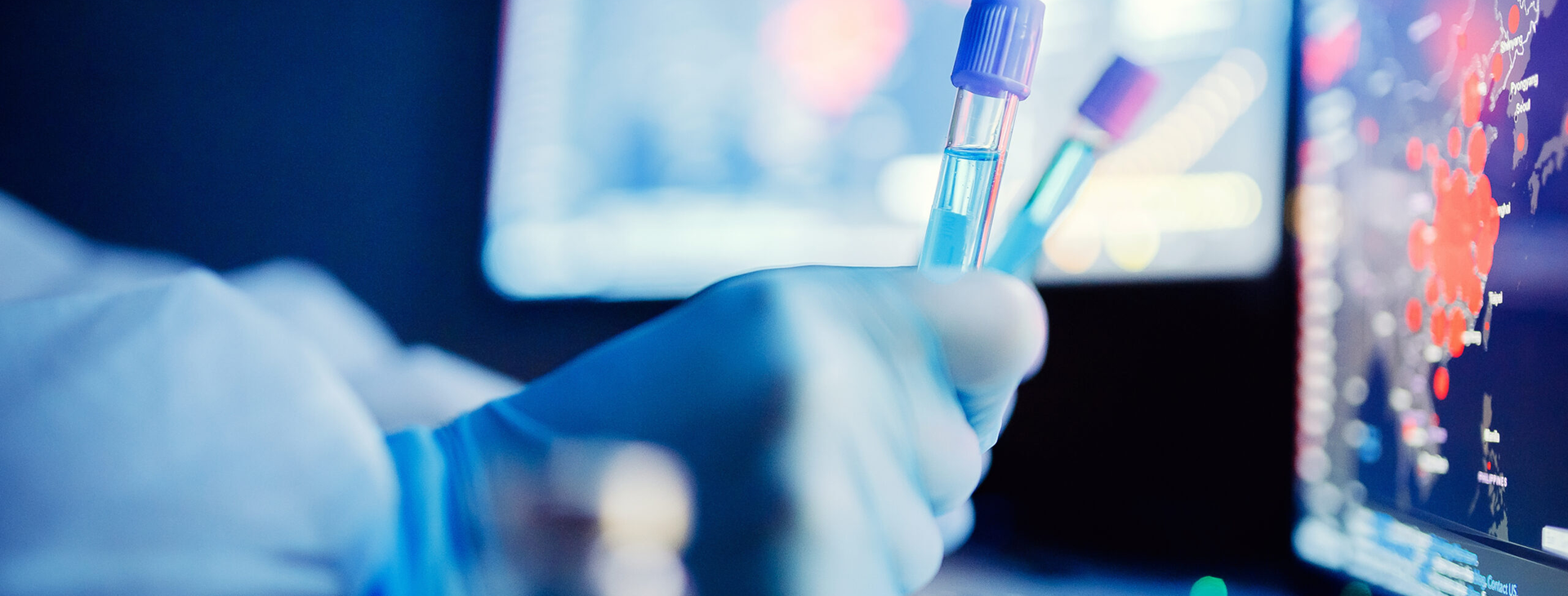 Mikrobiyolojik Analiz Laboratuvarı